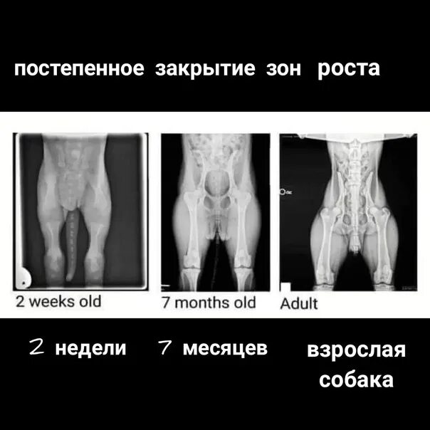 Три зоны роста. Зоны роста. Закрытие зон роста. Открытые зоны роста. Зоны роста закрываются.