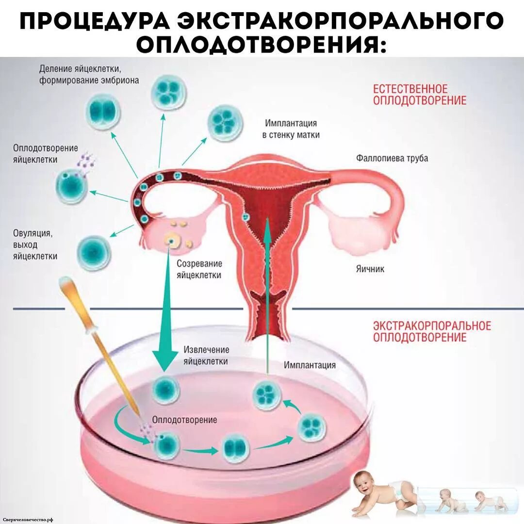 Сколько яйцеклеток есть у женщины