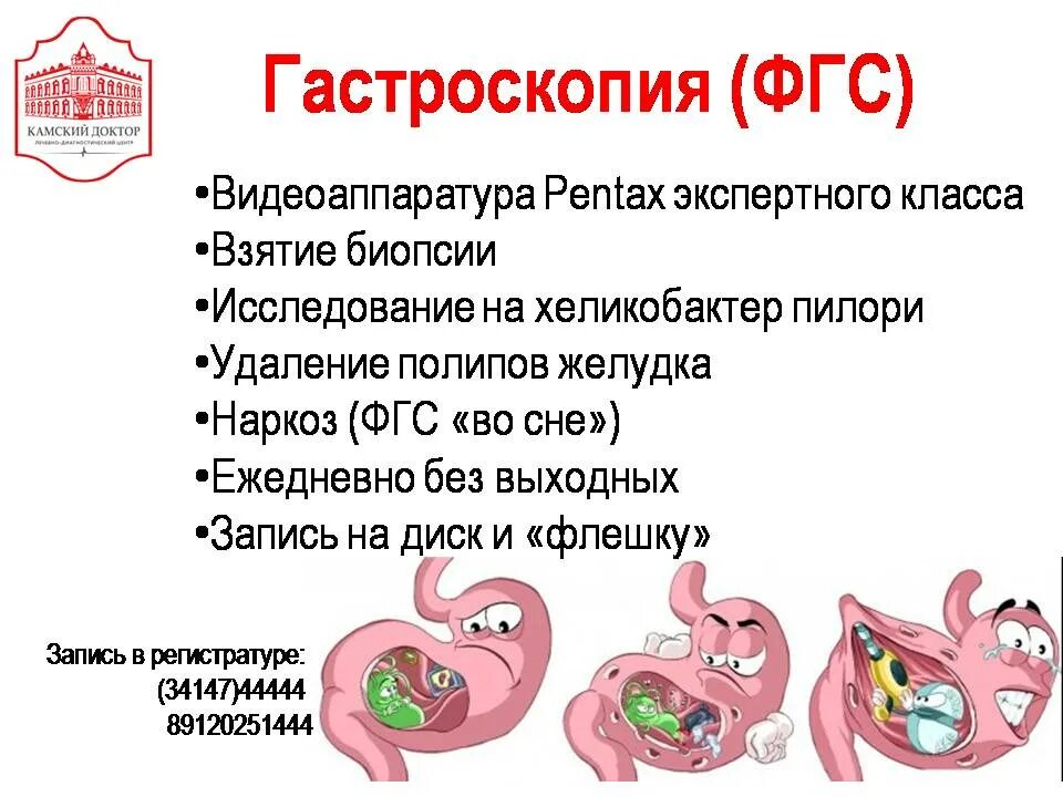 ФГС. ФГС желудка подготовка. Как расшифровывается ФГДС. ФГДС противопоказания.