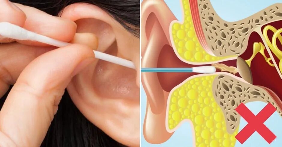 Как быстро почистить ухо