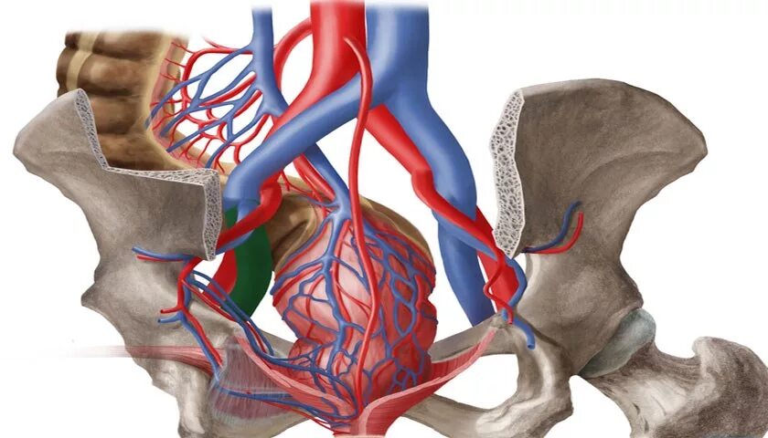 Препараты кровообращение малого таза. Подвздошная Вена анатомия. Варикозное расширение вен малого таза. Подвздошные вены анатомия. Варикоз подвздошной вены.