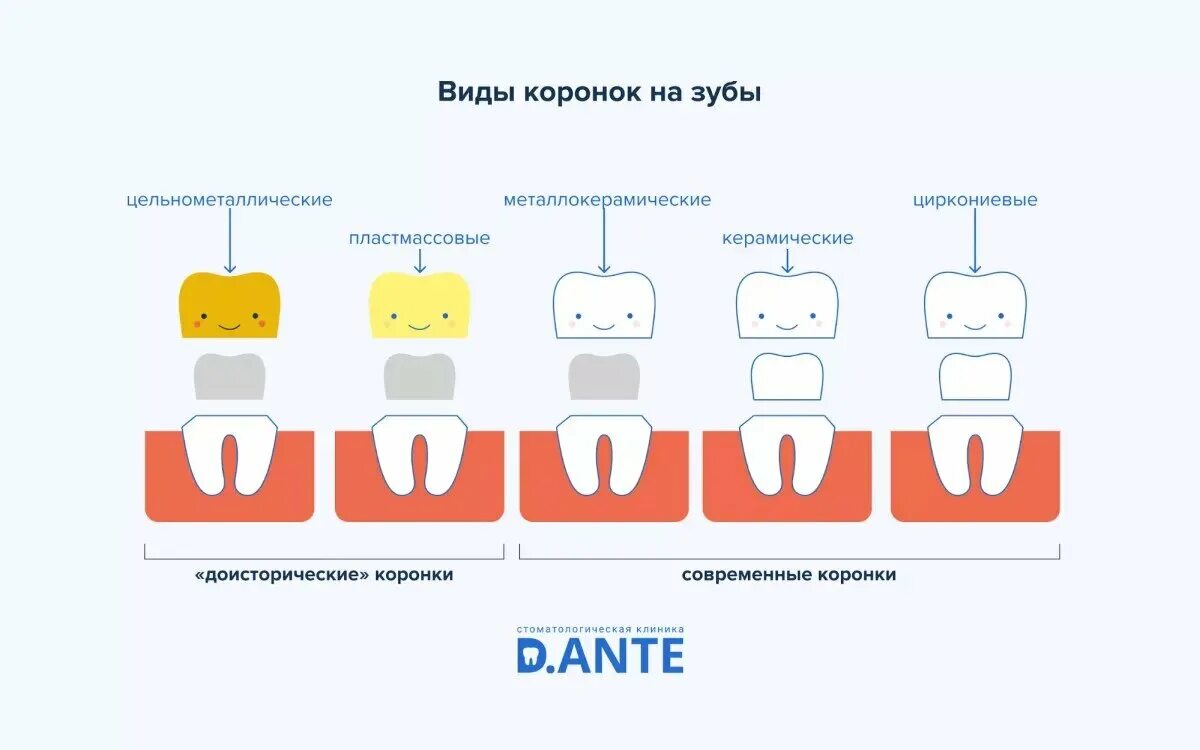 Коронки на зубы какие бывают и цены