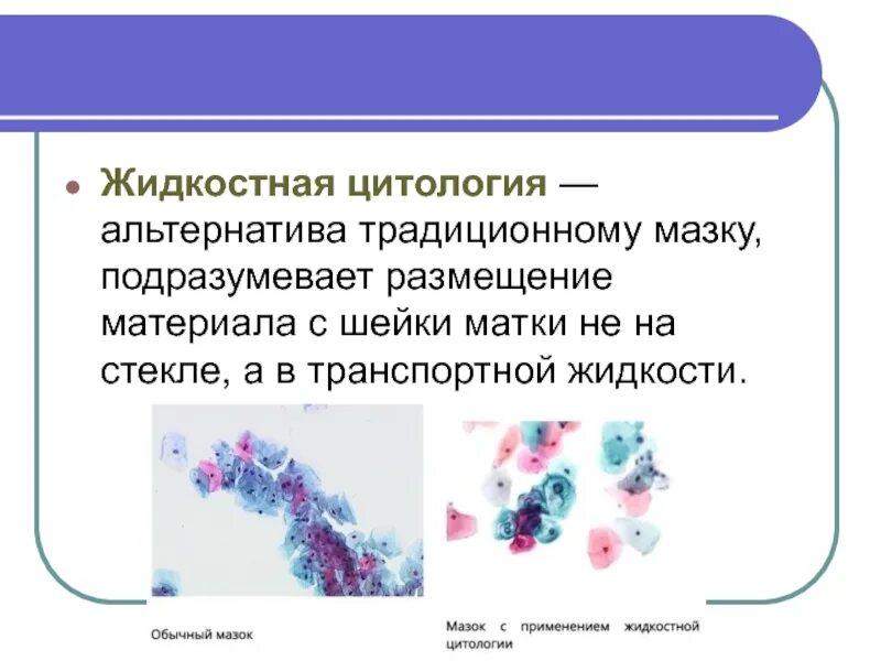 Цитология тест 5 класс. Жидкостное цитологическое исследование шейки матки. цитологическое исследование жидкостный метод. жидкостная цитология шейки методика. традиционное цитологическое исследование.