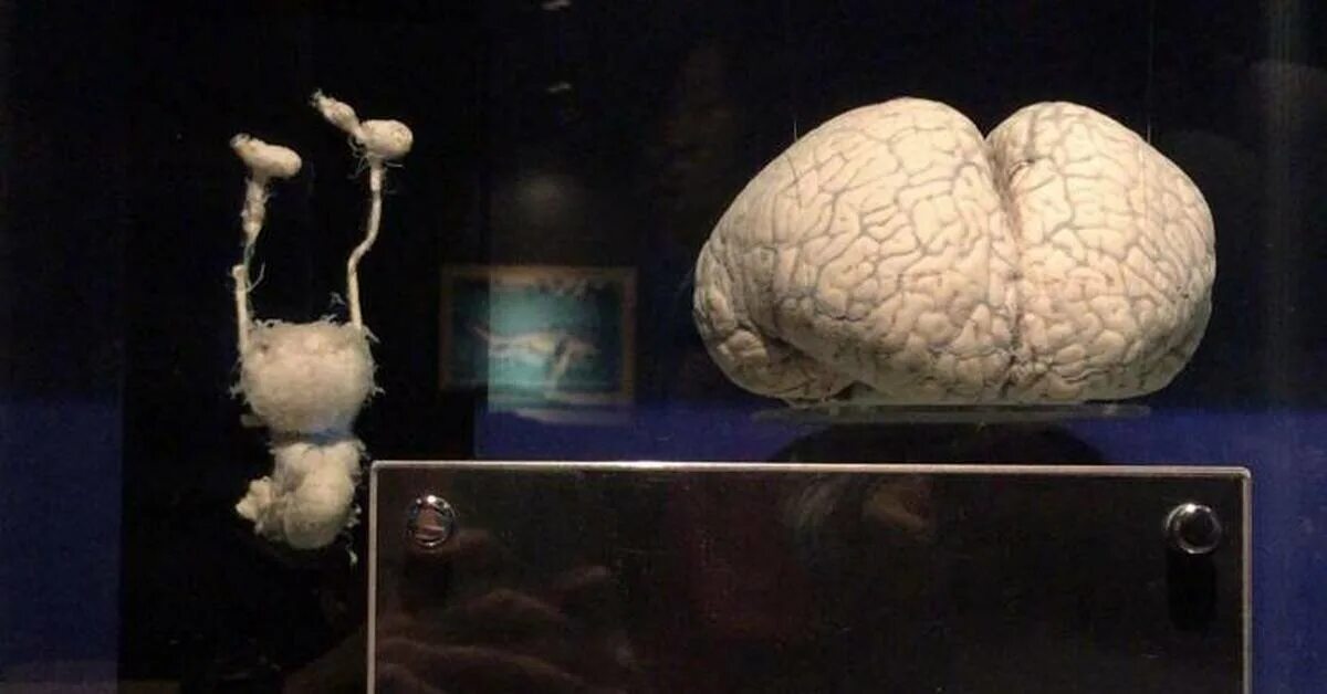 Какой мозг у акулы. Мозг акулы. Мозг дельфина мозг акулы. Размер мозга белой акулы.