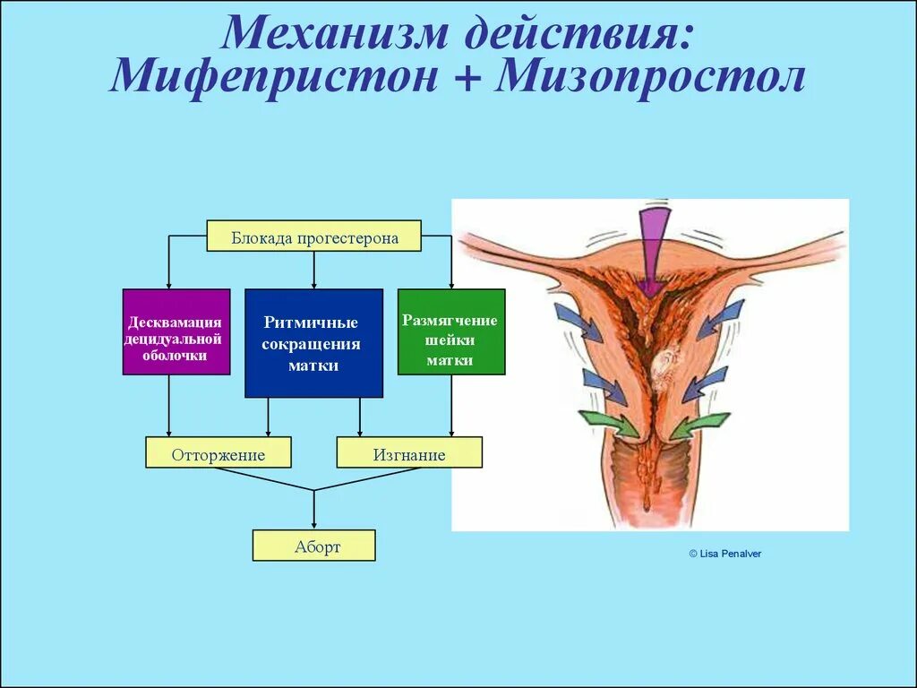 Механизм действия мифепристона и мизопростола. Мифепристон для стимуляции родовой деятельности. Мифепристон и мизопростол для прерывания беременности. Мифепристон при стимуляции родов.