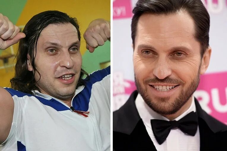 Фото пирожкова до и после пластики. Фото пирожкова до и после пластики. Александр ревва фото до пластики. Александр ревва до и после пластики. Александр ревва до и после.