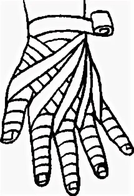 Техника наложения повязки перчатка. Рыцарская перчатка перевязка. Наложение повязки Рыцарская перчатка. Рыцарская перчатка десмургия. Рыцарская перчатка повязка алгоритм наложения.