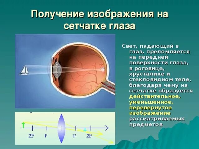 Изображение предмета на сетчатке. Изображение на сетчатке глаза. Возникновение изображения на сетчатке. Изображение на сетчатке глаза человека.