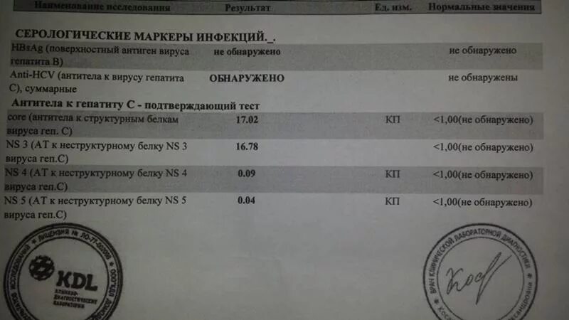 Кдл анализ на вич. Анализ на гепатит. Анализы гепатит а положительно. Результаты анализов на гепатит. Исследование крови на гепатиты в и с.