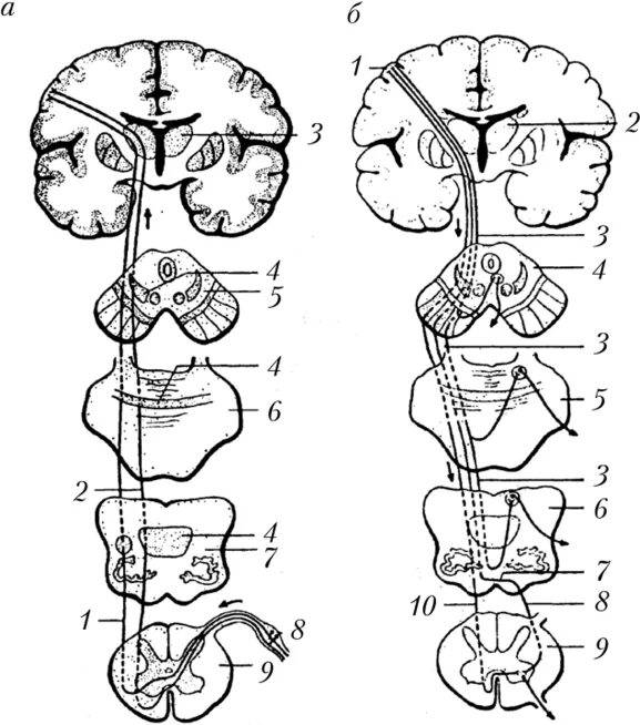 Нисходящий нервный путь. Схема восходящих путей спинного мозга. Афферентные пути головного и спинного мозга. Проводящие пути головного и спинного мозга схемы. Пирамидный путь неврология схема.