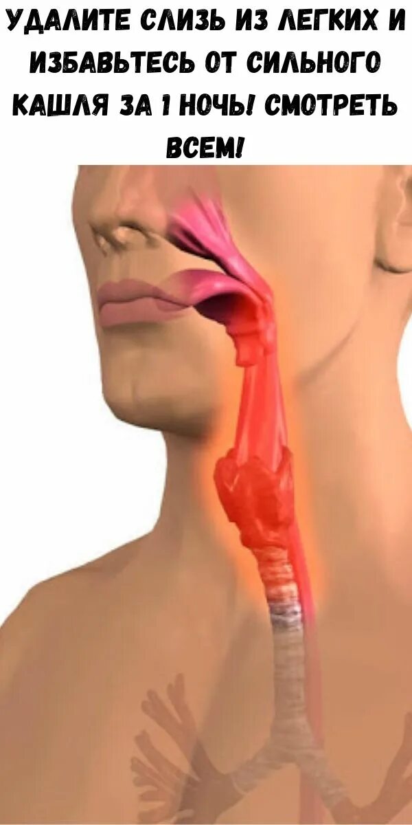 Как убрать мокроту из горла. Болит гортань и легкое покашливание. Мокрота в носоглотке у взрослого. Macrota v Gorle.