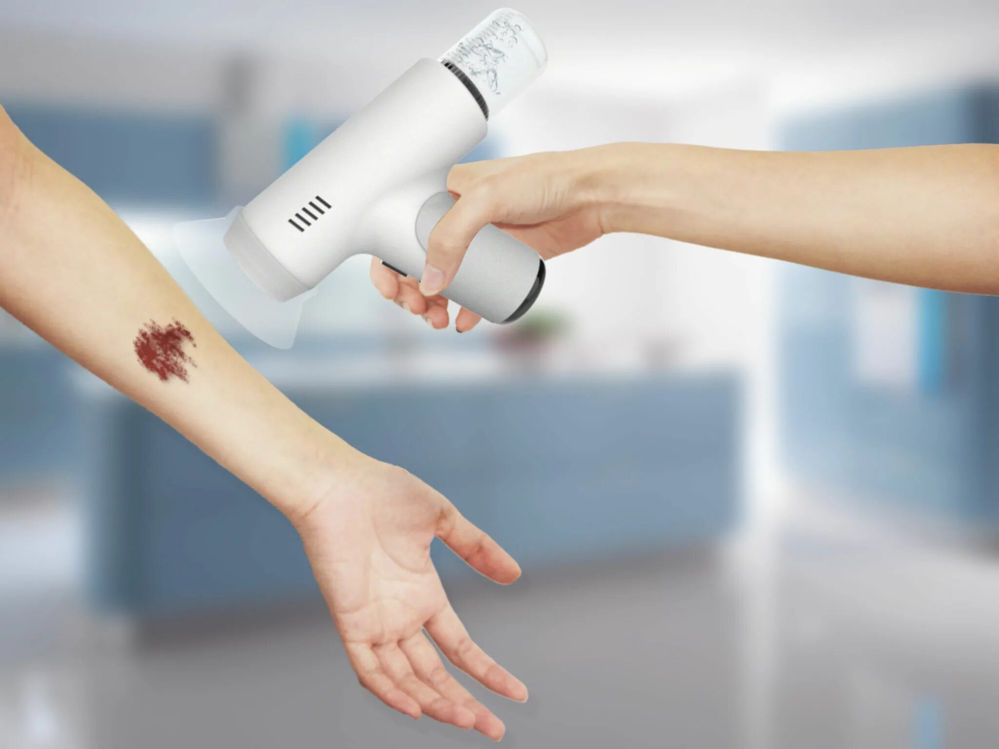 The wound must clean. The wound must clean. Жидкий пластырь для порезов на коже. Инфицированная рана флюктуация. The wound must clean.