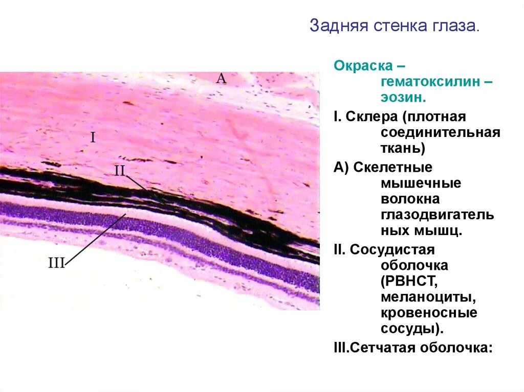 Фиброзная оболочка строение и функции. Задняя стенка глаза (сетчатая оболочка) (гематоксилин -4 эозин). Слои склеры гистология. Задняя стенка глаза гистология препарат. Задняя стенка глаза сетчатка гистология препарат.