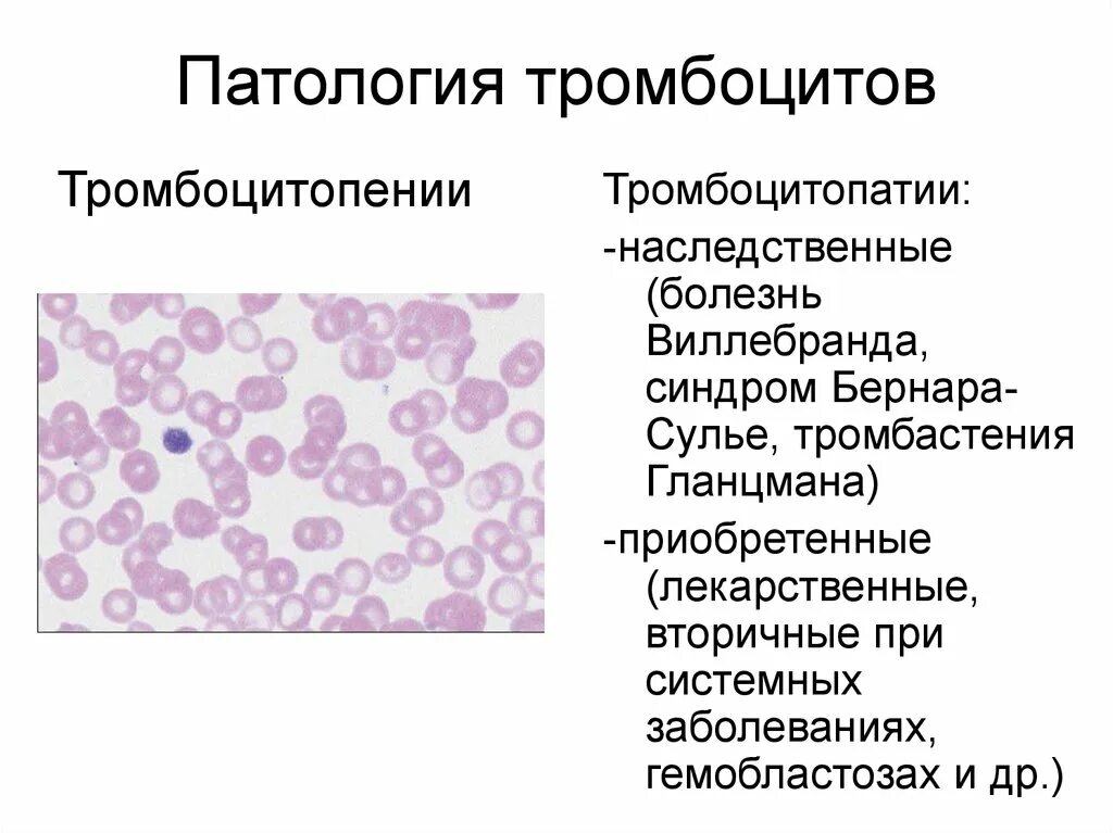 Тромбоцитопения кровотечение. Синдром серых тромбоцитов. Тромбоцитопатия микроскопия. Патологические формы тромбоцитов.