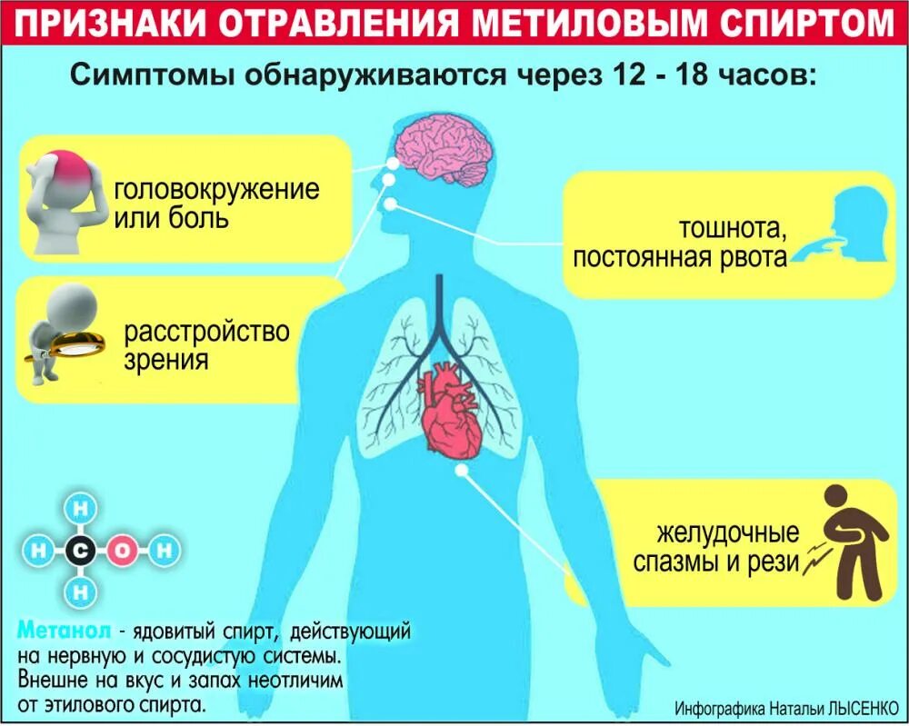 Отравление метанолом симптомы.