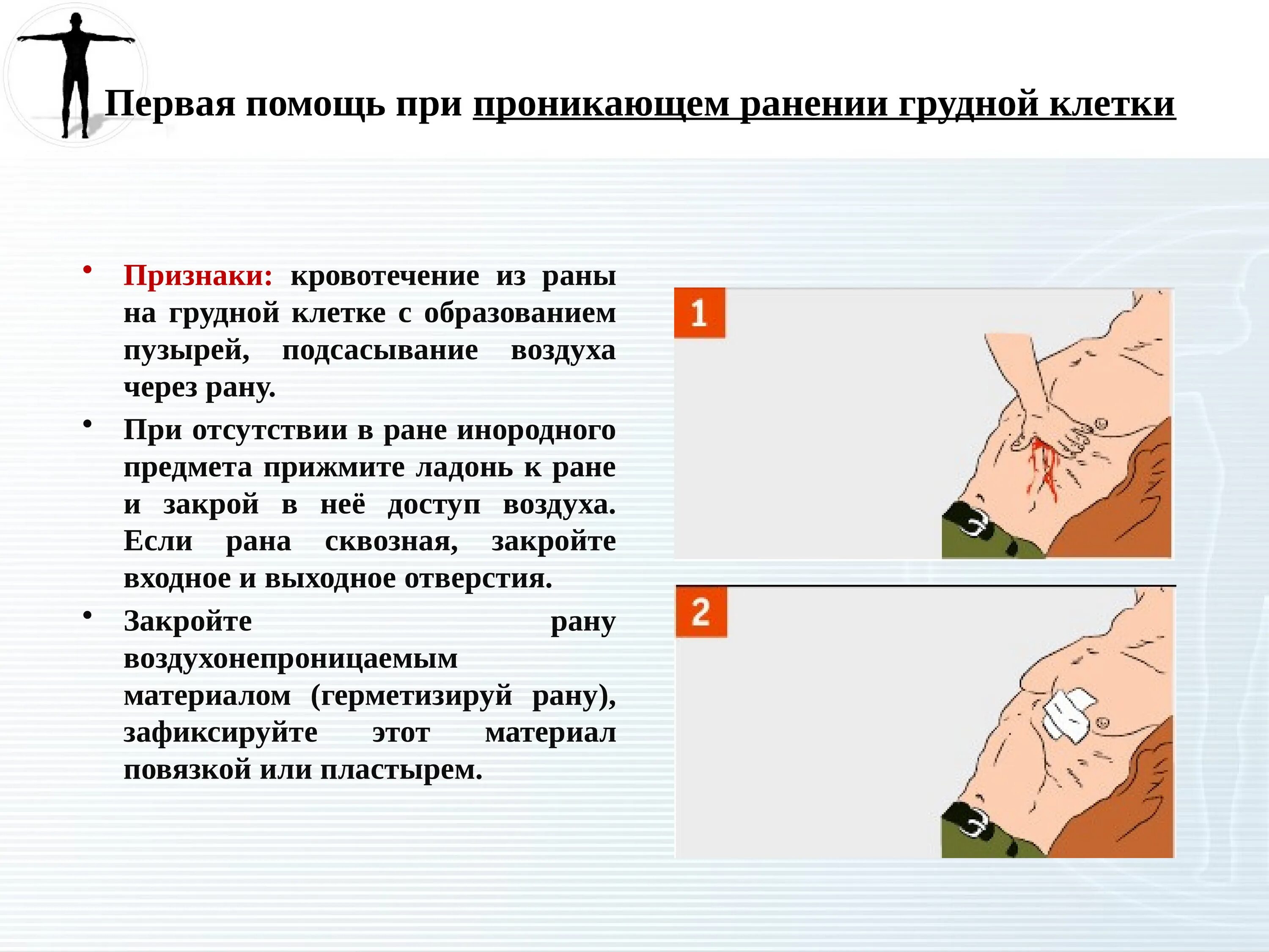 Этапы первой помощи при ранениях. Оказание первой помощи при ранении грудной клетки. Первая помощь при сквозном проникающем ранении грудной клетки. Оказание первой доврачебной помощи при ранении в грудную клетку. Проникающее ранение грудной клетки ПМП.