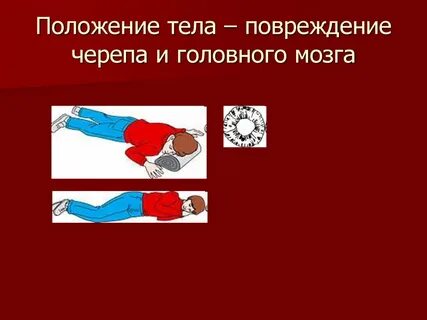 Повреждение туловища