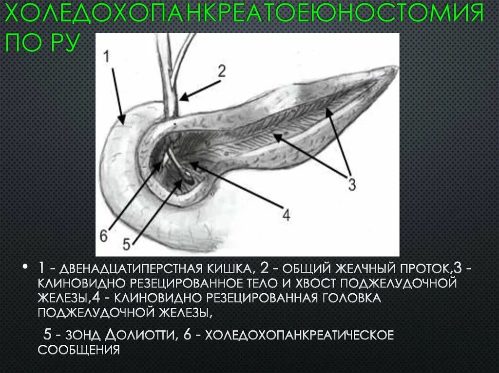 Орган имеет протоки открывающиеся в двенадцатиперстную кишку. Общий желчный проток открывается. Общий желчный проток в головке поджелудочной железы. Хвост поджелудочной железы. Общий желчный проток открывается в кишку.