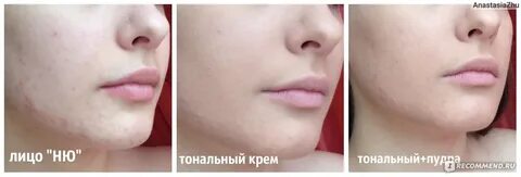 Тональный крем пятнами