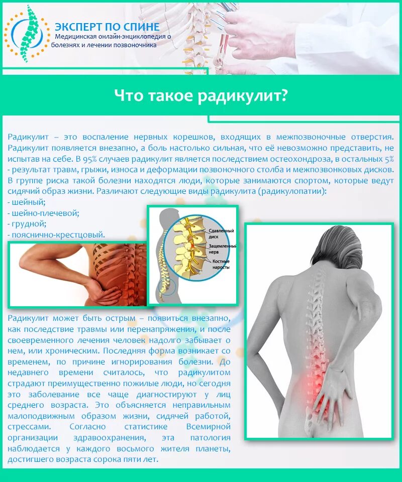 Симптомы поясничной радикулопатии. Пояснично-крестцовый радикулит симптомы. Клинический симптом пояснично-крестцового радикулита. Пояснично крестцовая радикулопатия. Корешковый. Синдром. Люмбалгия корешковый синдром.