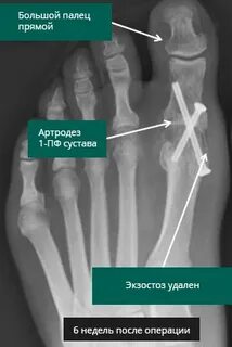 1 пфс