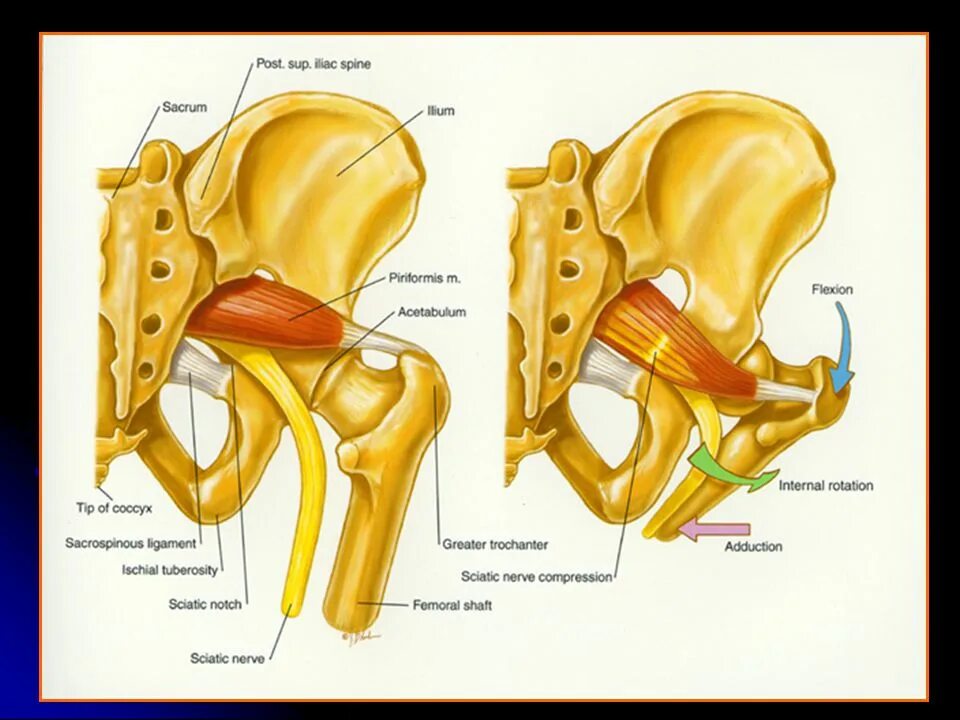 Тазобедренный сустав анатомия грушевидная мышца. Кости таза человека седалищный нерв. Строение мышц таза седалищный нерв. Седалищный нерв анатомия таз.