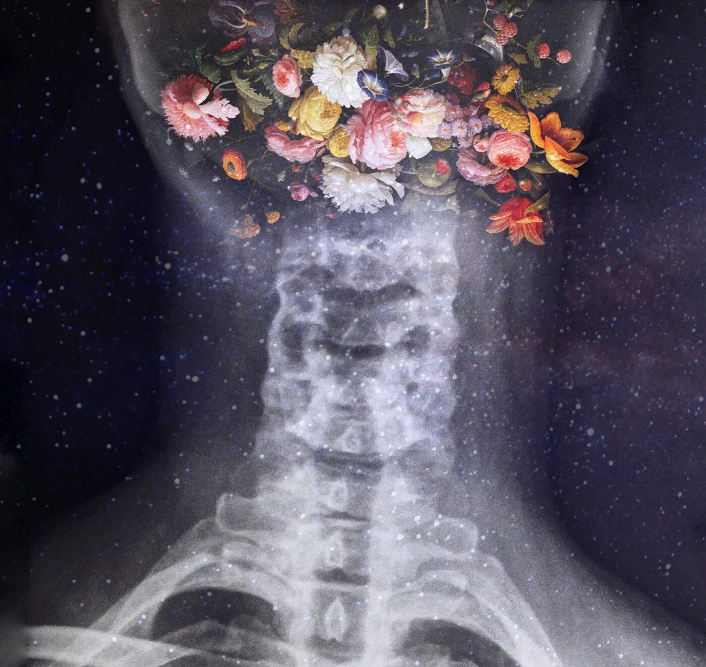 XRAY Flowers. Рентген обои. Bones музыкант Эстетика. Рентген Эстетика.