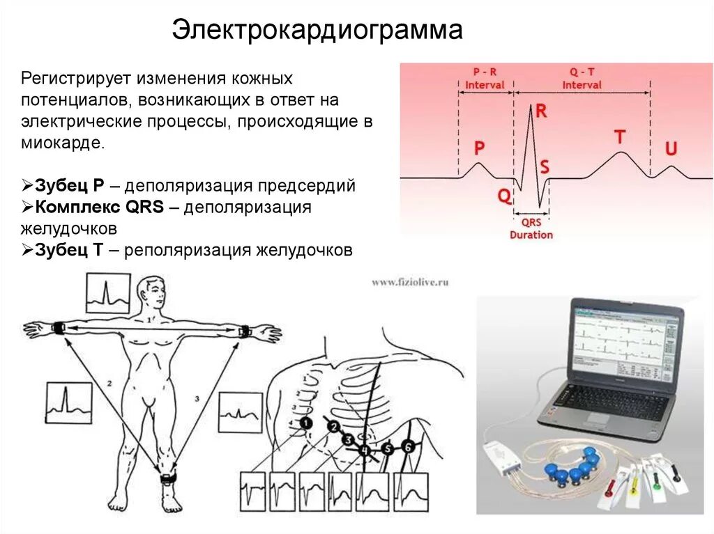 ЭКГ проекция электродов. Методика проведения ЭКГ 12 стандартных отведений. 2 Отведение ЭКГ. Заземляющий электрод при регистрации ЭКГ:. Соп экг