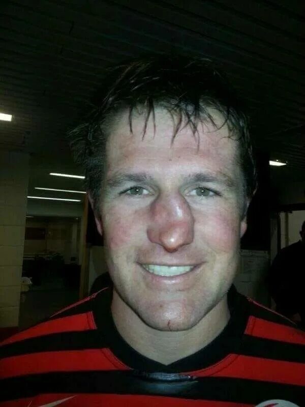 Worst injuries