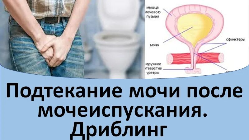 Рези при мочеиспускании у мужчин в головке. Подтекание мочи после мочеиспускания. тренировка мочевого пузыря у мужчин. подтекание мочи у мужчин после мочеиспускания. после мочеиспускания в мочевом пузыре остается моча.