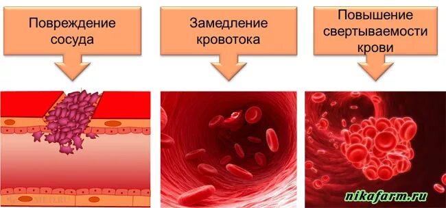 Увеличение свертывания крови