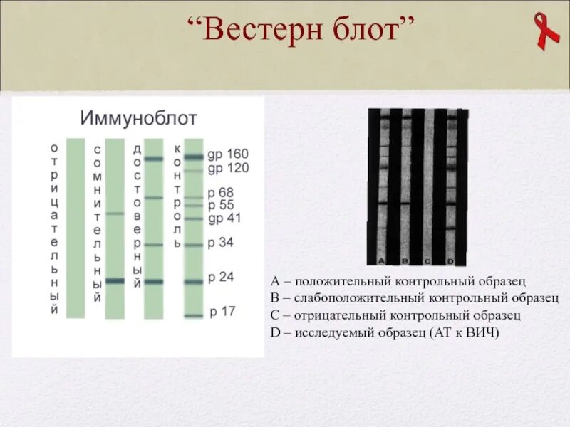 Иммунный блоттинг ВИЧ инфекции. Иммуноблоттинг вестерн Блот. ВИЧ инфекция иммуноблот. Положительный иммуноблот на ВИЧ.