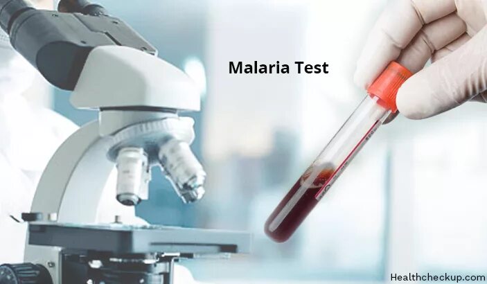 Малярия тестирование. Malaria diagnosis. Microscope ad-5030rz II. Malaria smear какие показатели. Malaria Rapid Diagnostic Test (RDTS.