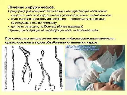 Подслизистая резекция
