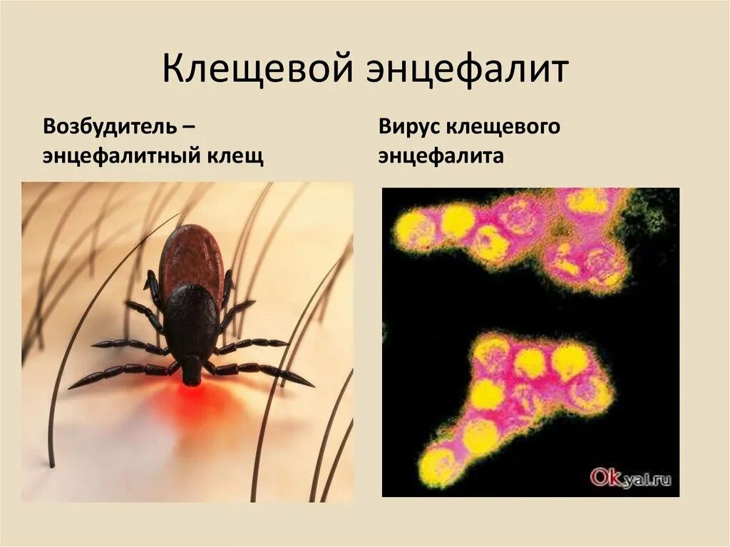 Является переносчиком клеща заболевание. Клещевой энцефалит возбудитель заболевания. Клещевого вирусного энцефалита возбудитель инфекции-. Переносчиком вируса весенне-летнего энцефалита является. Клещи клещевой энцефалит строение.