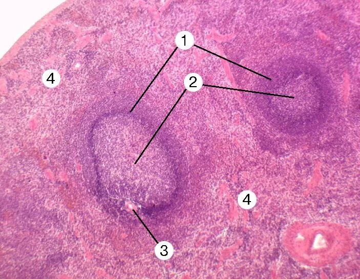 Селезенка гистология препарат. Селезенка человека препарат гистология. Тимус гистология гистология. Зоны селезенки гистология. В селезенке образуются клетки