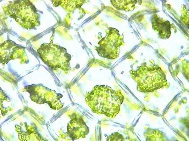 Наблюдение за плазмолизом в клетках. Плазмолиз элодеи. Клетки элодеи под микроскопом плазмолиз. Хлоропласты в клетках листа элодеи. Плазмолиз в клетках листа элодеи.