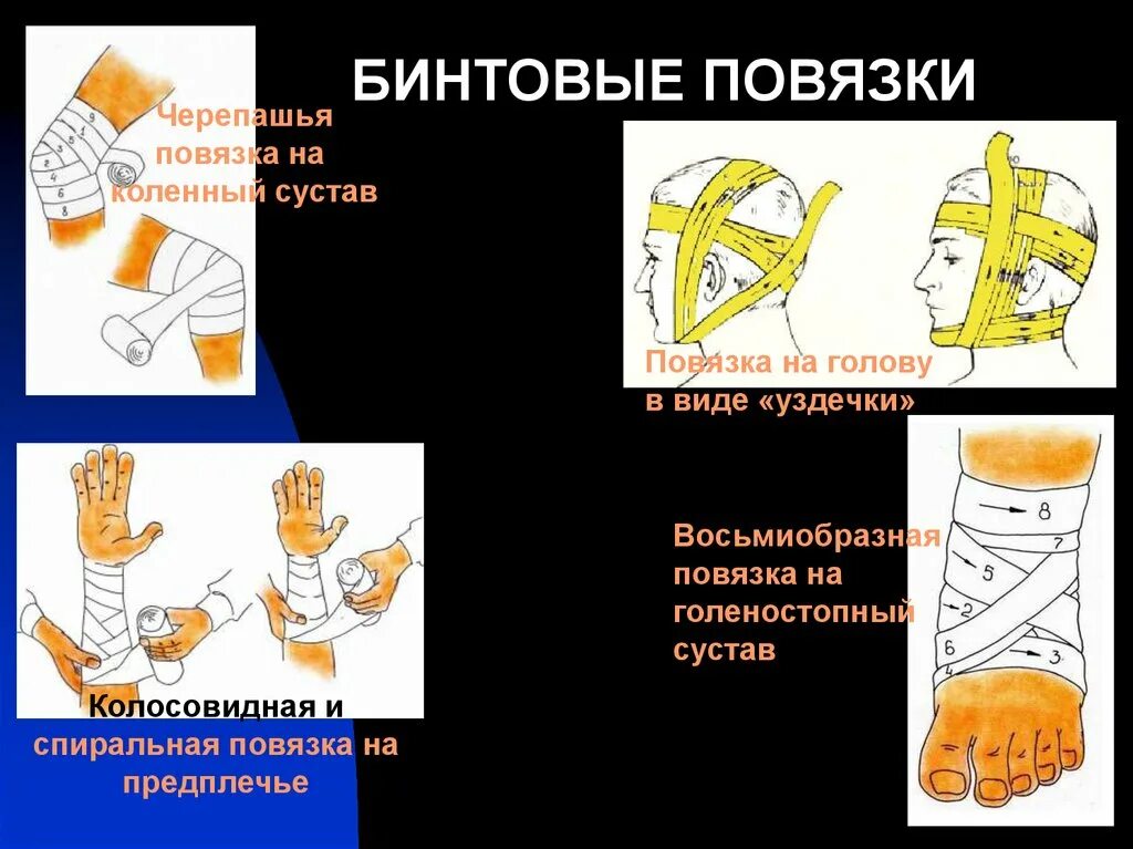 Основные типы повязок. Бинтовые повязки. Типы бинтовых повязок. Бинтовые повязки повязки. Не бинтовые повязки.