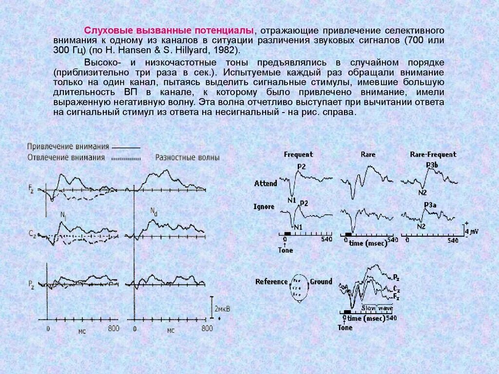 Слуховые стимулы. Среднелатентные слуховые вызванные потенциалы. Коротколатентные слуховые вызванные потенциалы (КСВП). Метод вызванных потенциалов. Вызванные потенциалы ЭЭГ.