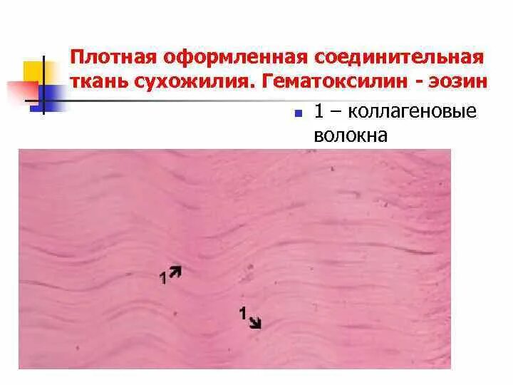 Плотная оформленная ткань. Плотная оформленная и неоформленная соединительная ткань. Плотная неоформленная соединительная ткань кожи. Плотная оформленная соединительная ткань гематоксилин эозин. Плотная волокнистая неоформленная соединительная ткань кожа пальца.