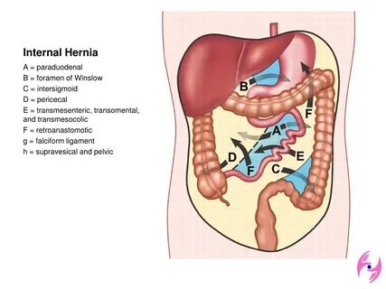 Internal video