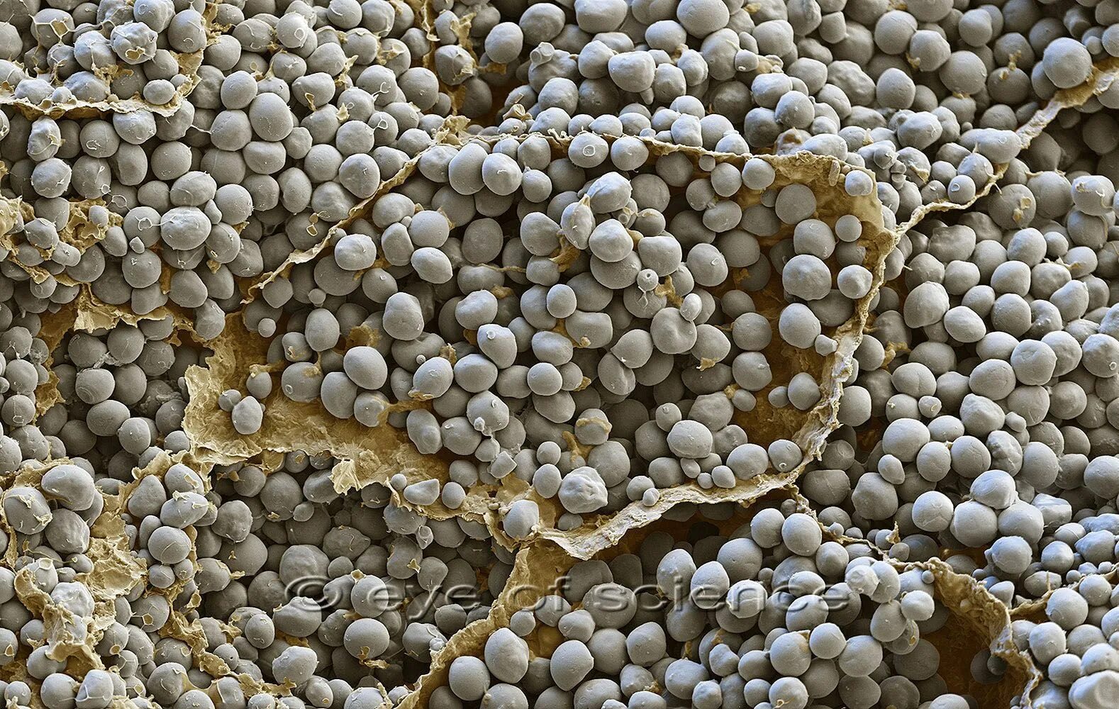Появление морщинистых семян. Крахмал под микроскоп кукуруза. Крахмальные зерна кукурузы под микроскопом. Zea Mays под микроскопом. Крахмальные зерна гороха под микроскопом.