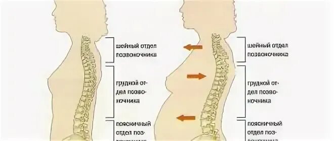 35 недель беременности болит спина