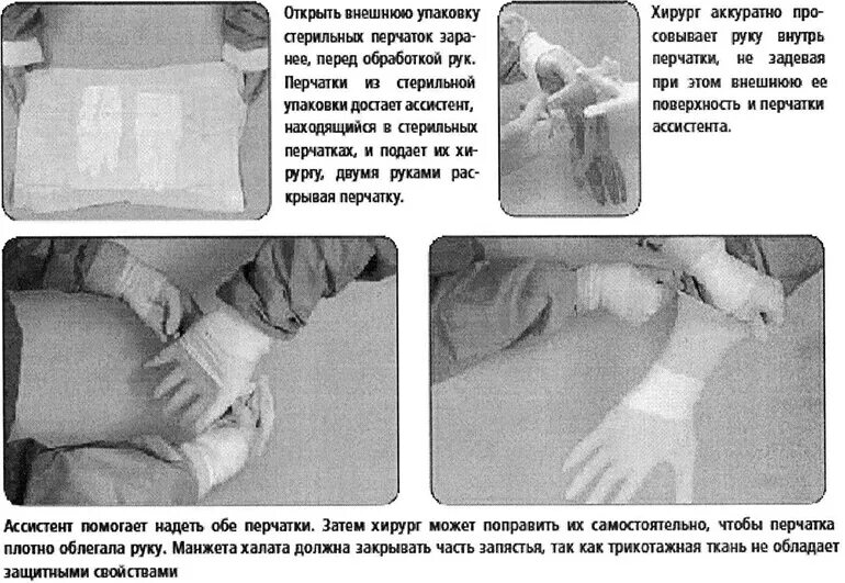 После снятия перчаток руки. Техника одевания стерильных перчаток алгоритм. Техника одевания и снятия стерильных перчаток. Техника надевания стерильных медицинских перчаток. Одевание стерильных перчаток алгоритм.