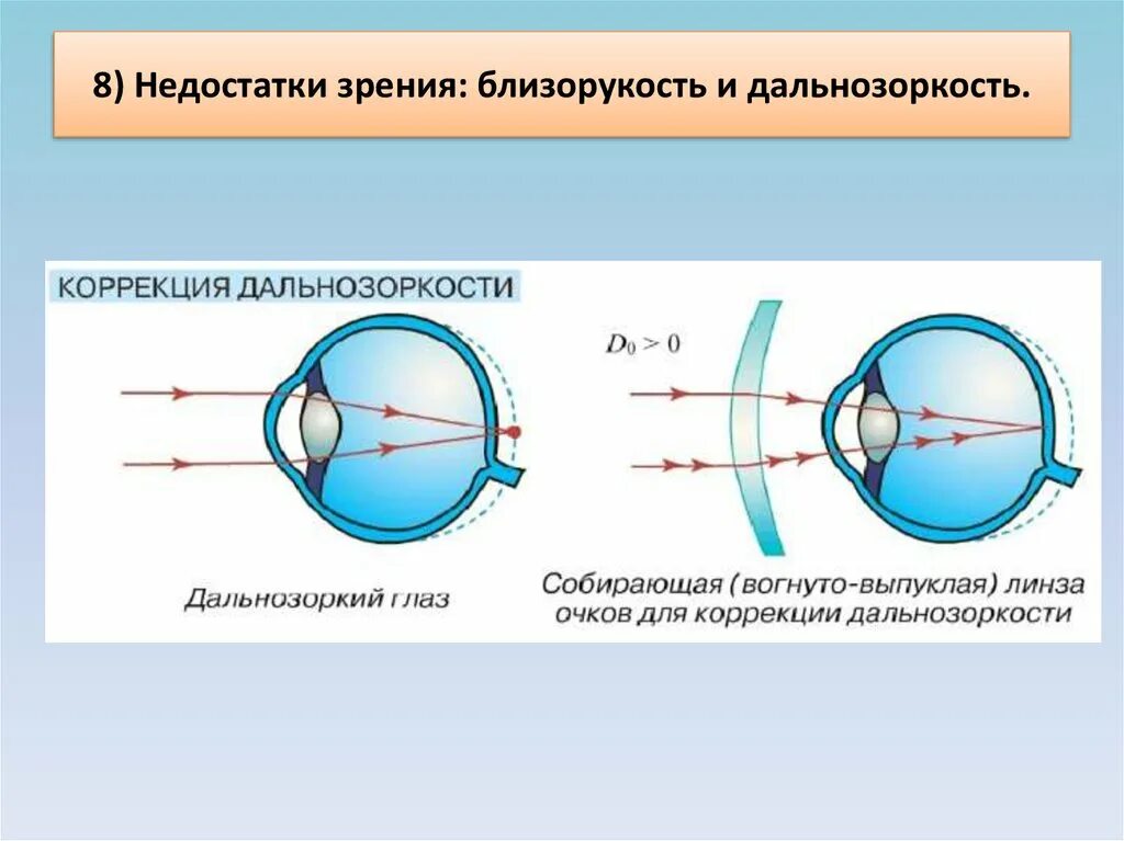 Дефекты зрения близорукость. Глаз дальнозоркость и близорукость. Дефекты зрения дальнозоркость. Зрение близорукость и дальнозоркость. Какое зрение при дальнозоркости