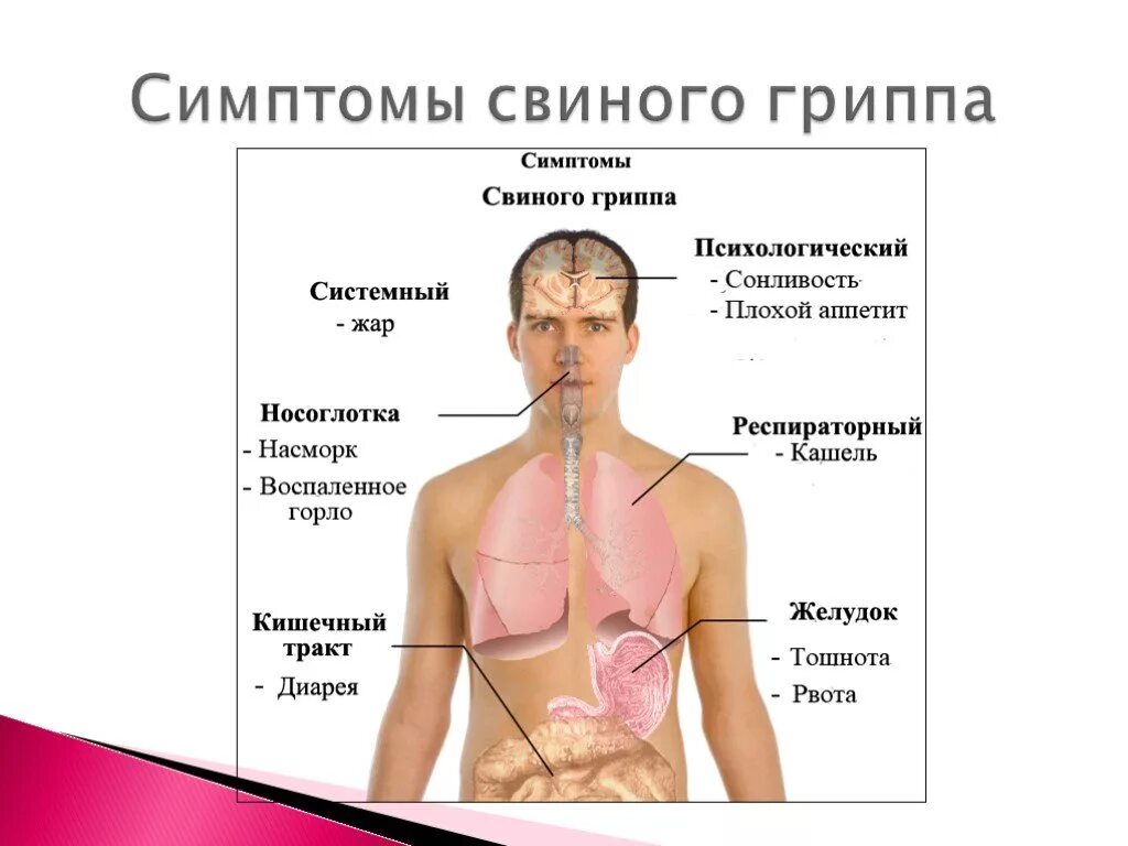 Перечисли симптомы гриппа