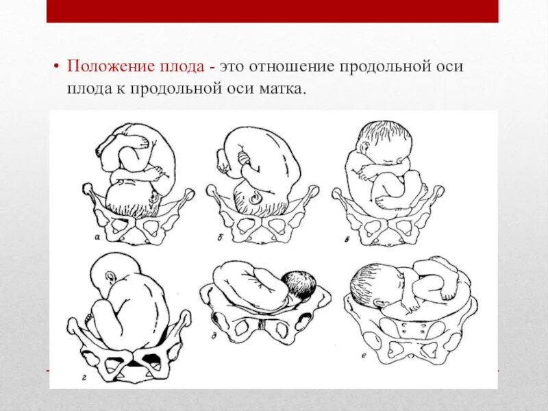 Положение плода продольное предлежит головка. Продольное и поперечное положение плода. Продольное поперечное косое положение плода. Положение косое предлежание головное. Положение предлежание позиция вид позиции плода.