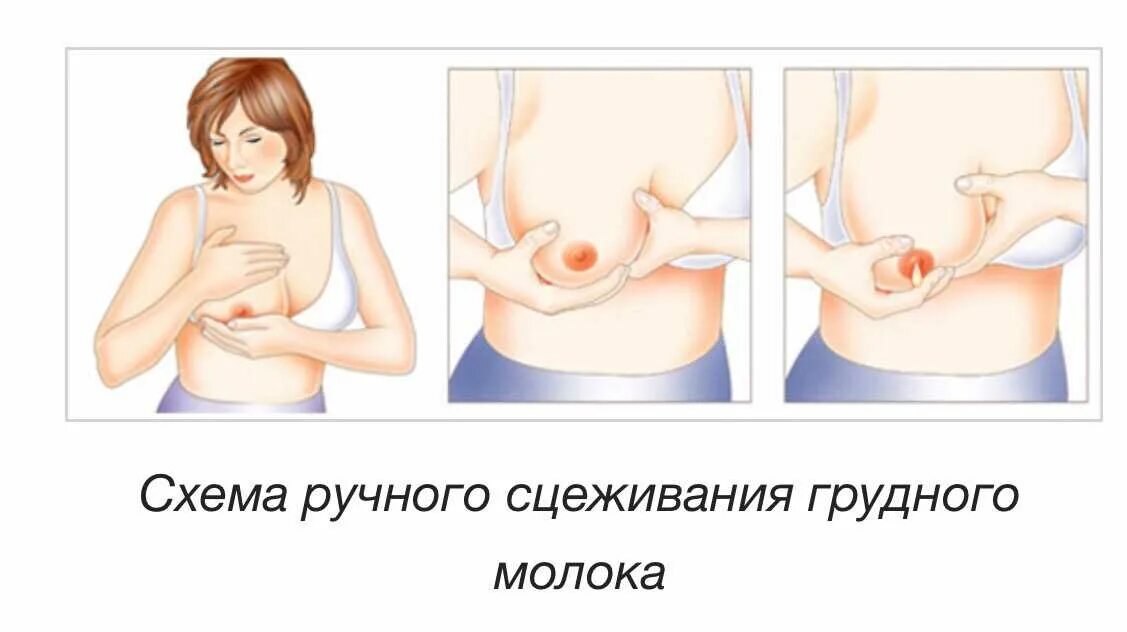 Как выглядит молозиво после родов у первородящих Поддерживающая помощь больным новорожденным. (Модуль 8) online presentation