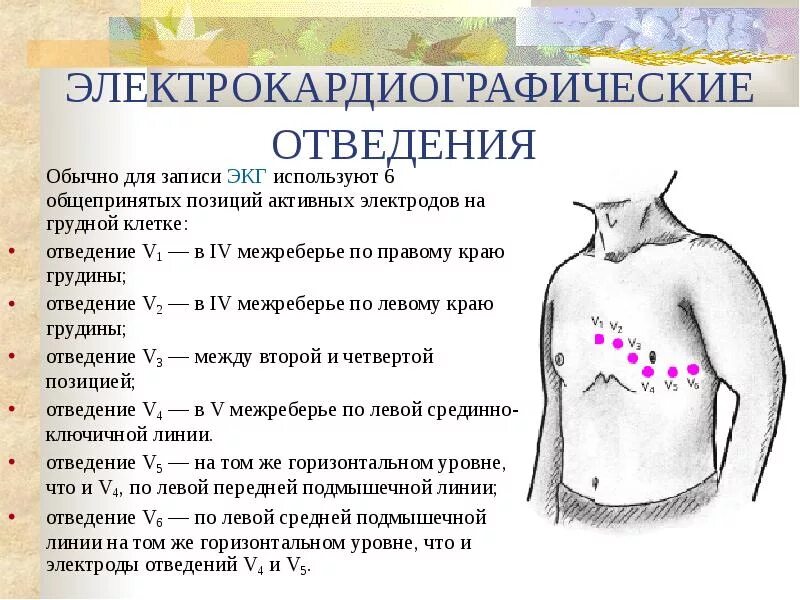 12 Отведений ЭКГ схема. Наложение электродов грудные отведения ЭКГ. Электроды ЭКГ на грудной клетке. Грудные отведения на ЭКГ электроды. Правые грудные отведения