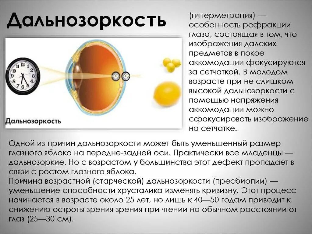 Почему у людей пожилого возраста развивается дальнозоркость. Гиперметропия этиология. Гиперметропия рефракция. Степени миопии и гиперметропии. Дальнозоркость.